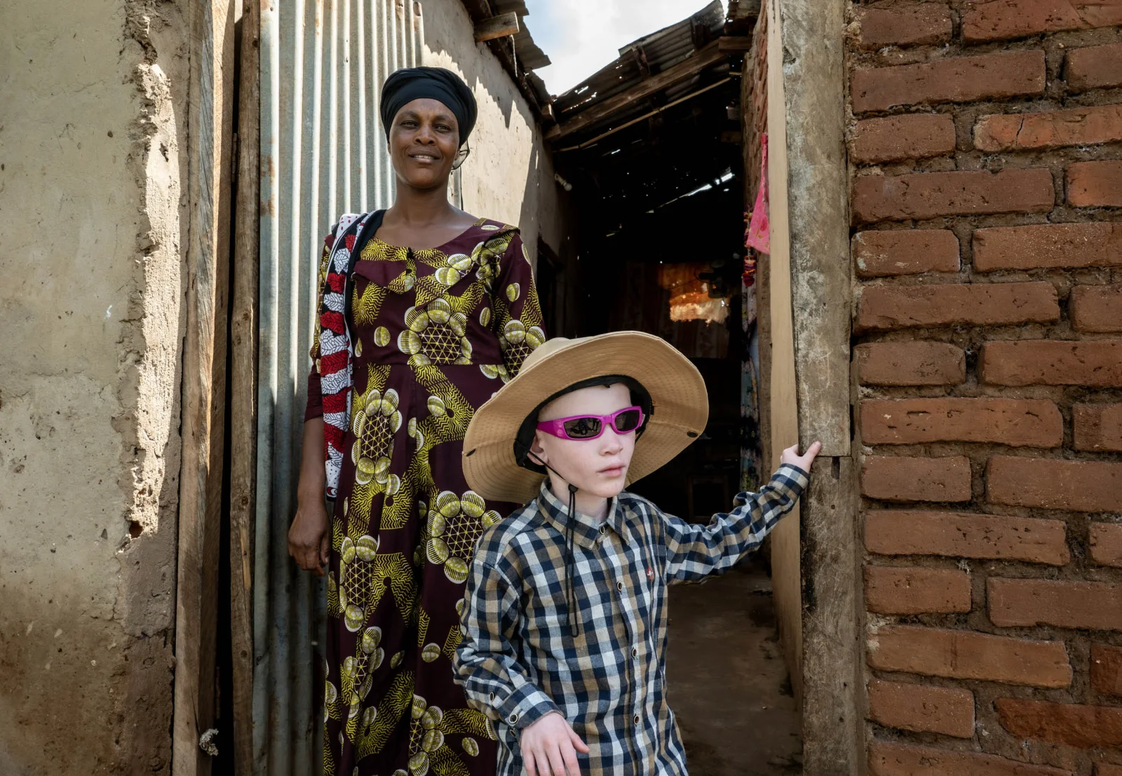 Lives in Shadows: Albino Families in Tanzania